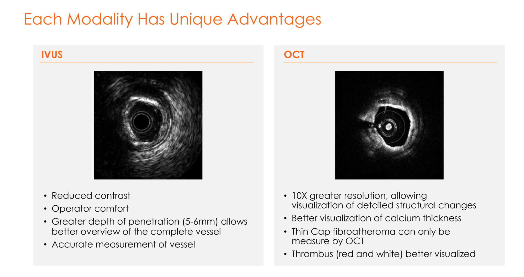 Conavi’s Novasight Shines New Light On Coronary Interventions - BioTuesdays