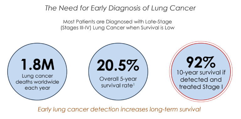 bioAffinity rolling out CyPath for early detection of lung cancer ...