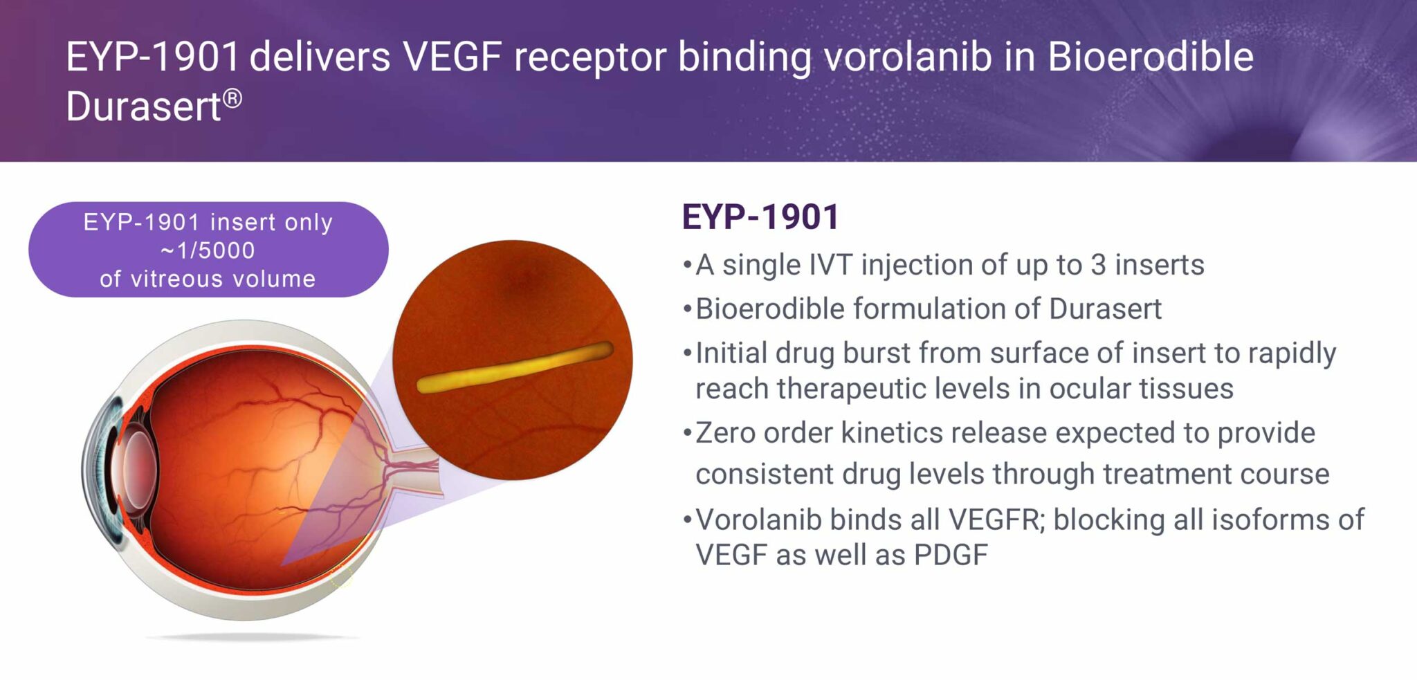 EyePoint Focused On Long-lasting Treatments For Wet AMD And DR ...