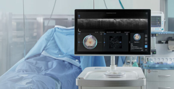 Perimeter Medical Imaging AI