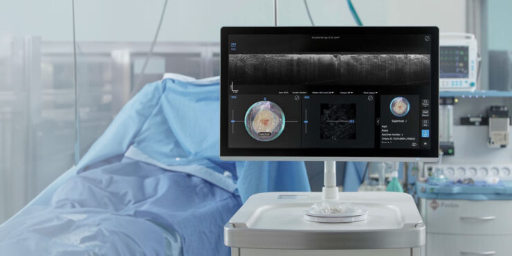 Perimeter Medical Imaging AI